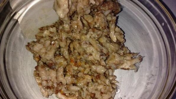 селедка под шубой в желе